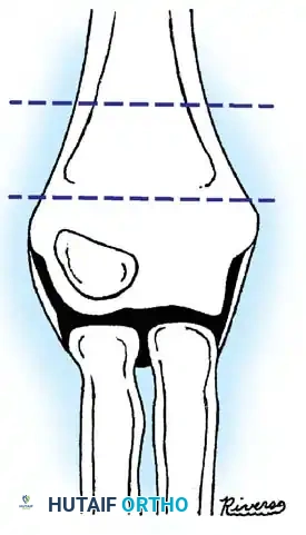 Hutaifortho's Orthopaedic Diagram