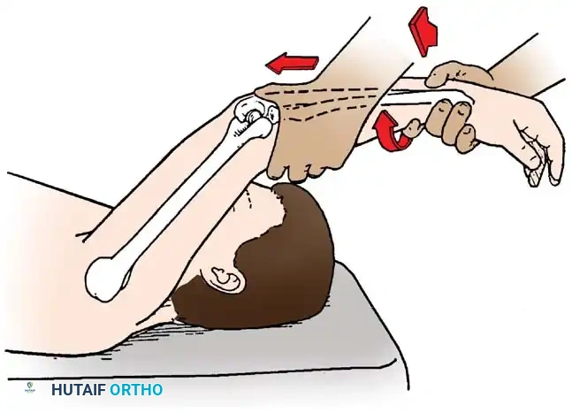 Intraoperative visualization of medial compartment pathology and ligamentous laxity.