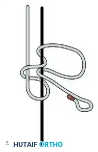 ELBOW Surgical Diagram