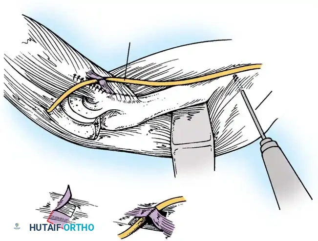 Hutaifortho's Orthopaedic Diagram