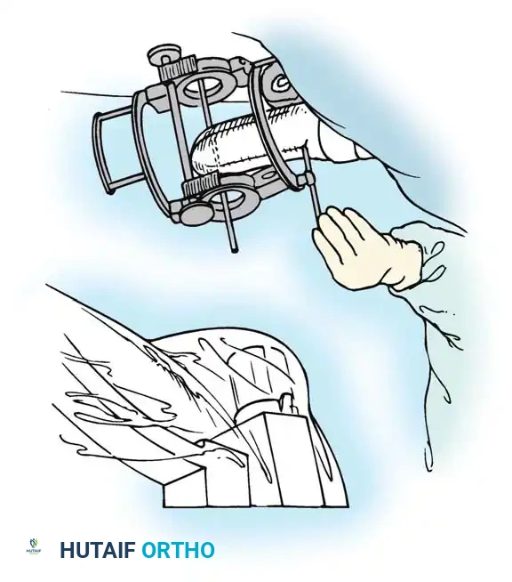 Hutaifortho's Orthopaedic Diagram