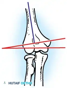 Hutaifortho's Orthopaedic Diagram