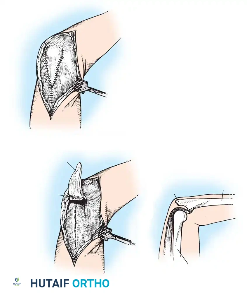 Hutaifortho's Orthopaedic Diagram