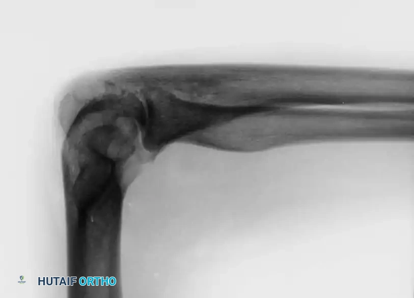 Hutaifortho's Orthopaedic Diagram