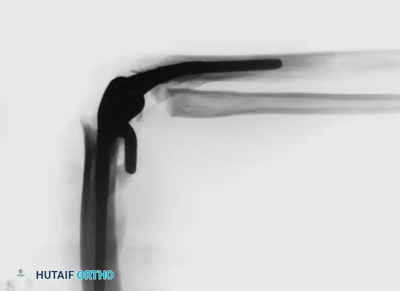 Hutaifortho's Orthopaedic Diagram
