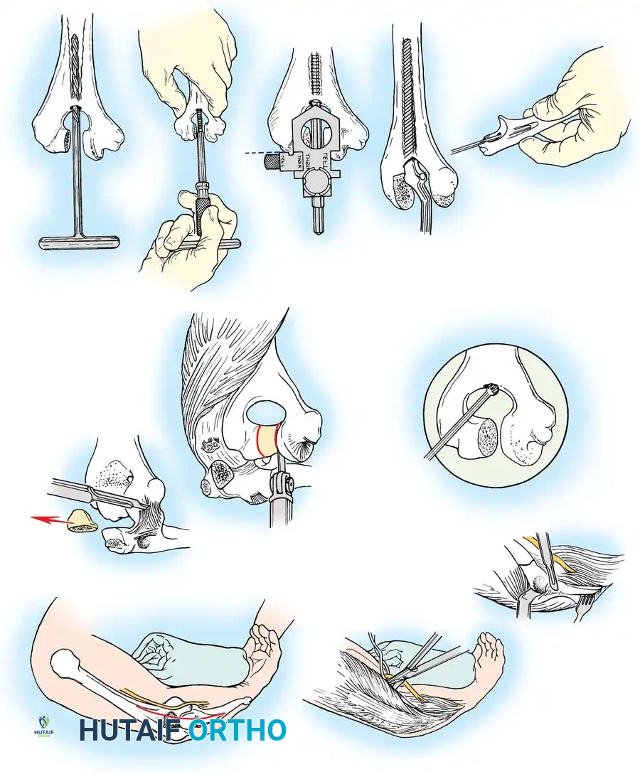 Hutaifortho's Orthopaedic Diagram