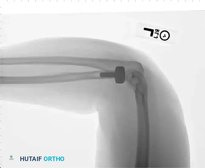 Hutaifortho's Orthopaedic Diagram