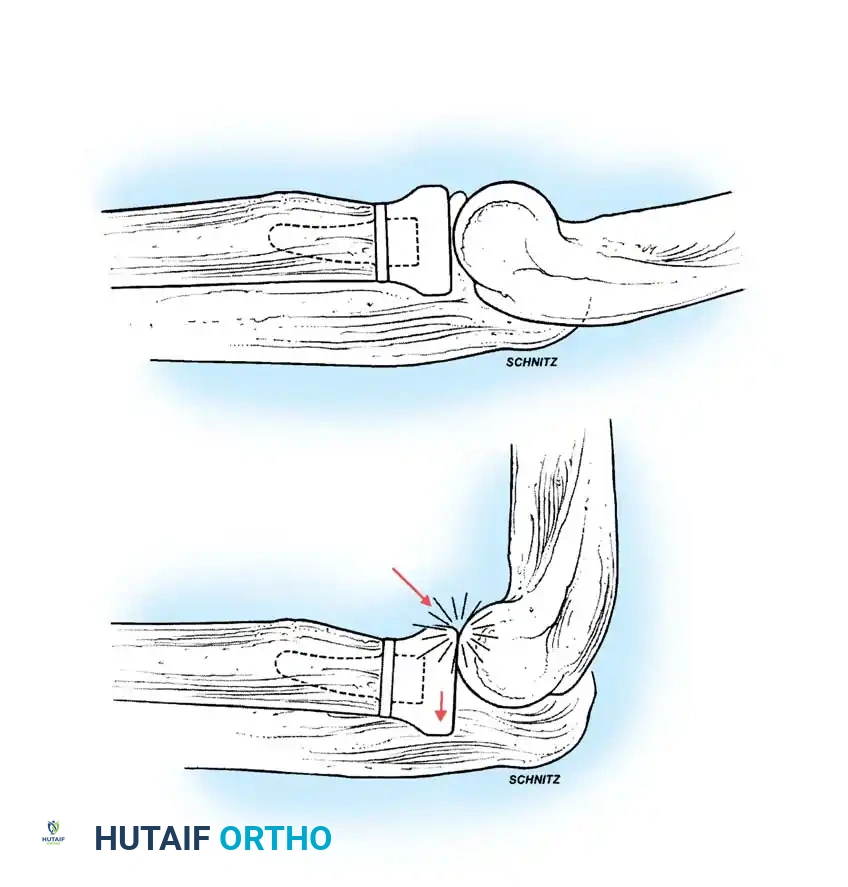 Hutaifortho's Orthopaedic Diagram