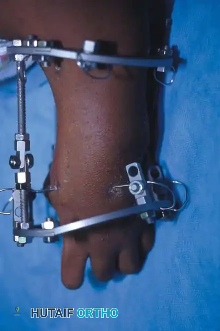 Hutaifortho's Orthopaedic Diagram