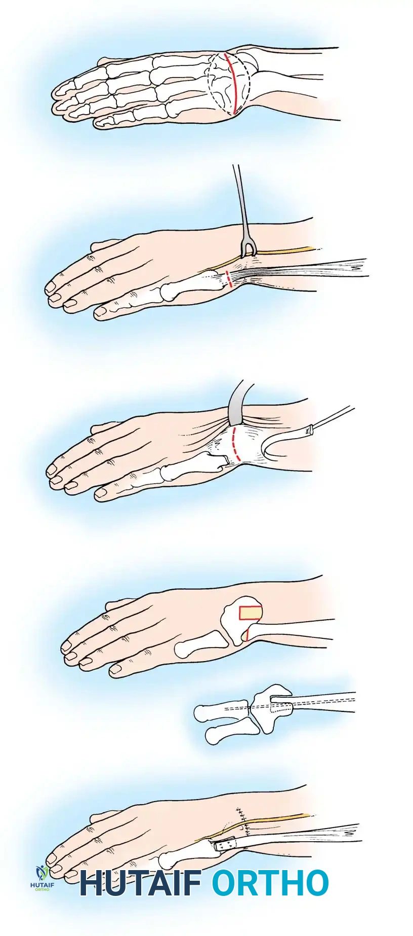 Hutaifortho's Orthopaedic Diagram