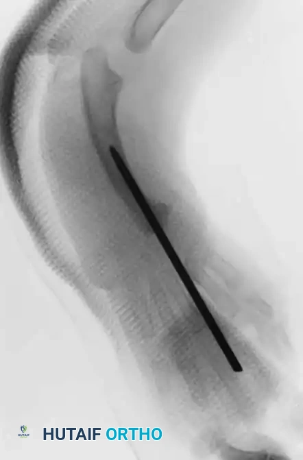 Hutaifortho's Orthopaedic Diagram