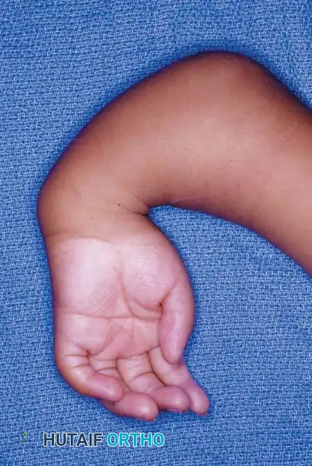 Hutaifortho's Orthopaedic Diagram