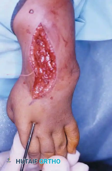 Hutaifortho's Orthopaedic Diagram