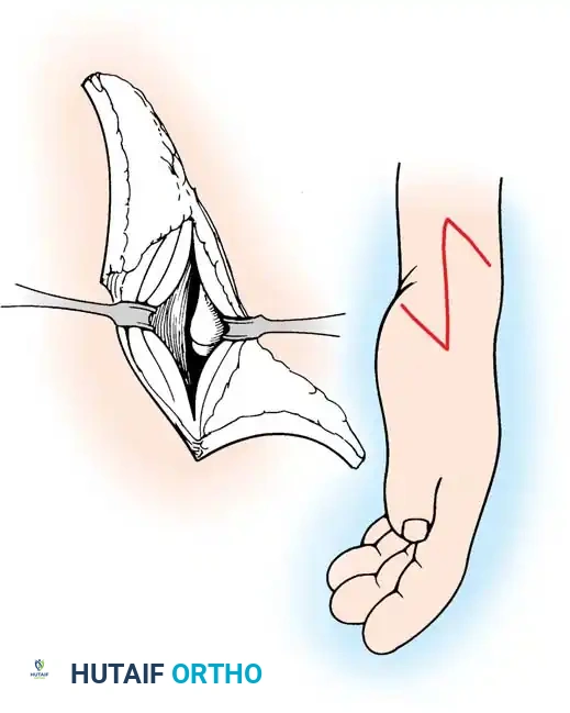 Hutaifortho's Orthopaedic Diagram