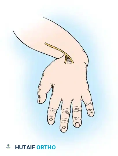 Hutaifortho's Orthopaedic Diagram