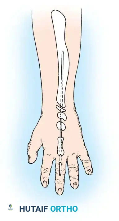 Hutaifortho's Orthopaedic Diagram