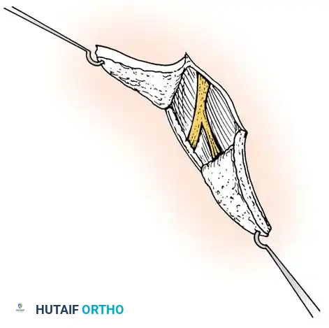 Hutaifortho's Orthopaedic Diagram