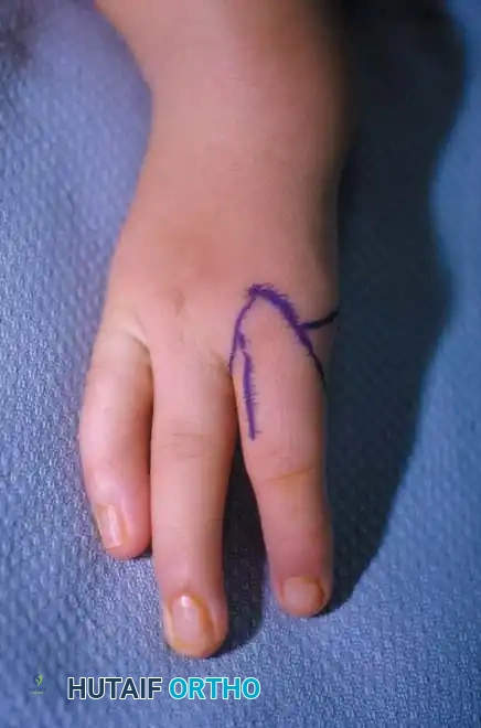 Hutaifortho's Orthopaedic Diagram