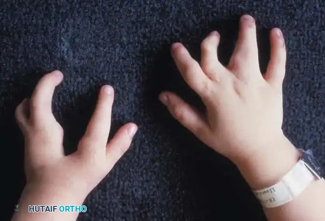 Hutaifortho's Orthopaedic Diagram