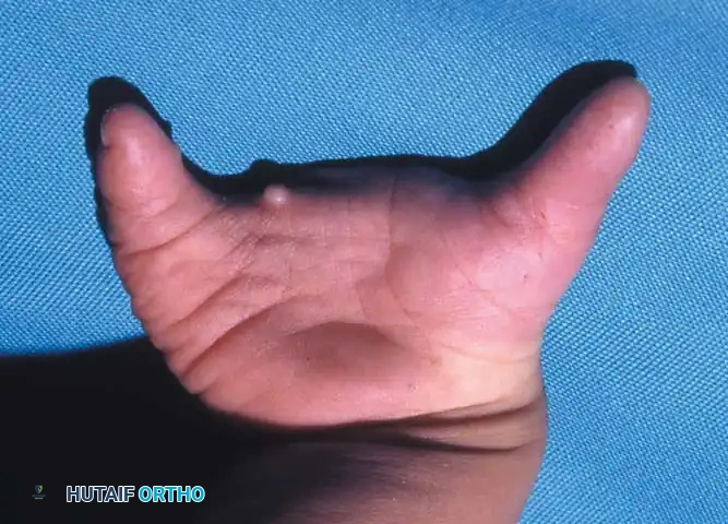 Hutaifortho's Orthopaedic Diagram