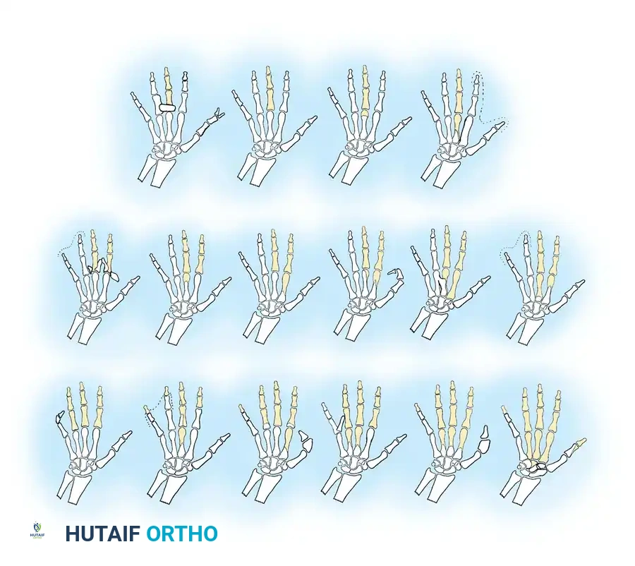 Hutaifortho's Orthopaedic Diagram