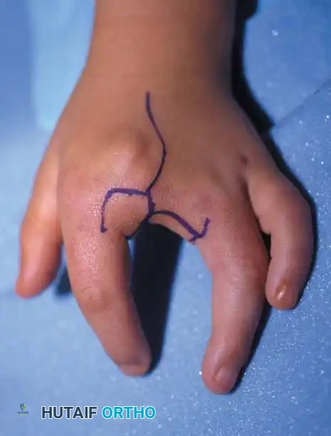 Hutaifortho's Orthopaedic Diagram