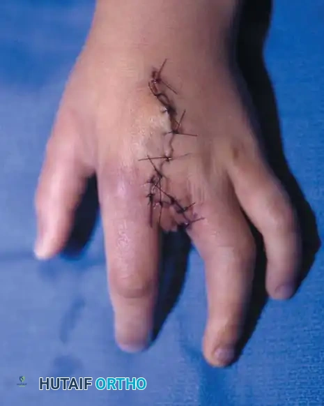 Hutaifortho's Orthopaedic Diagram