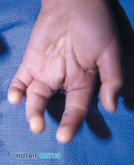 Hutaifortho's Orthopaedic Diagram