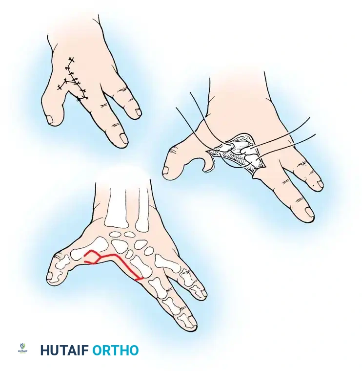 Hutaifortho's Orthopaedic Diagram