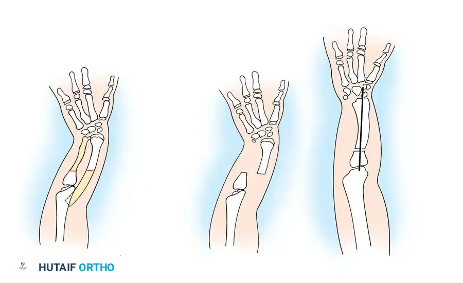Hutaifortho's Orthopaedic Diagram