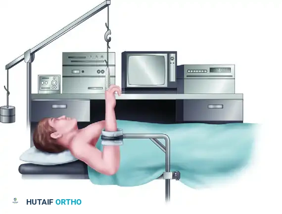 Principles and Techniques of Wrist Arthroscopy: Equipment, Positioning, and Indications