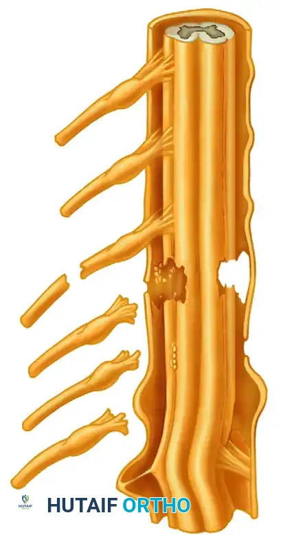 Brachial Plexus Injuries: Comprehensive Diagnosis and Surgical Management