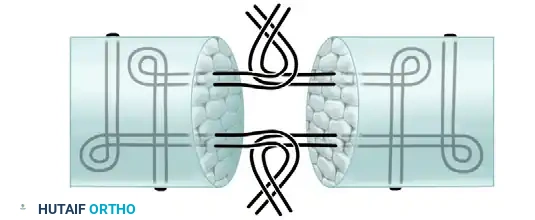 Hutaifortho's Orthopaedic Diagram