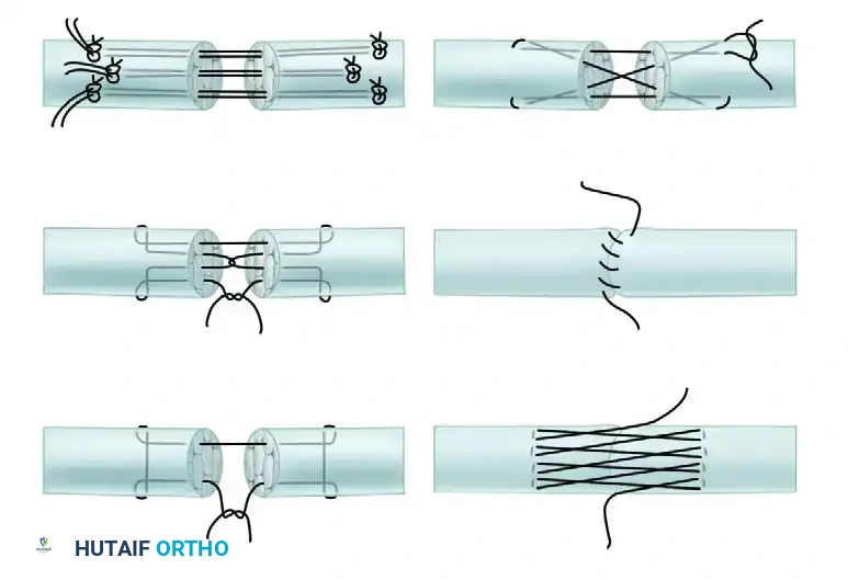 Hutaifortho's Orthopaedic Diagram