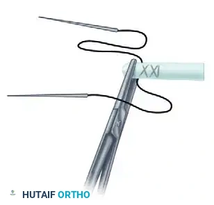 Advanced Suture Configuration