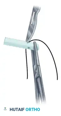 Hutaifortho's Orthopaedic Diagram