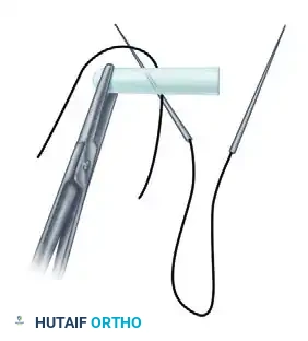 Hutaifortho's Orthopaedic Diagram