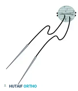 Advanced Suture Configuration