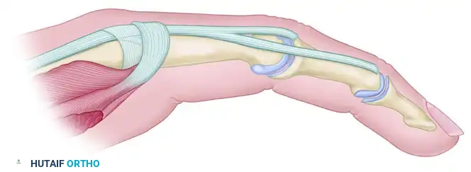 Appearance after Littler release