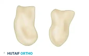 Transverse (axial) body