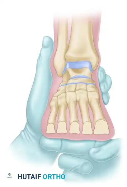 Checking Metatarsal Heads