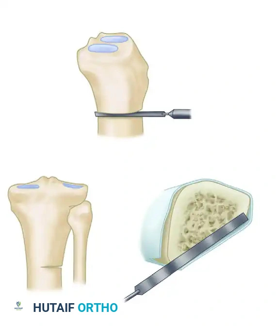Hutaifortho's Orthopaedic Diagram