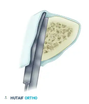 Hutaifortho's Orthopaedic Diagram