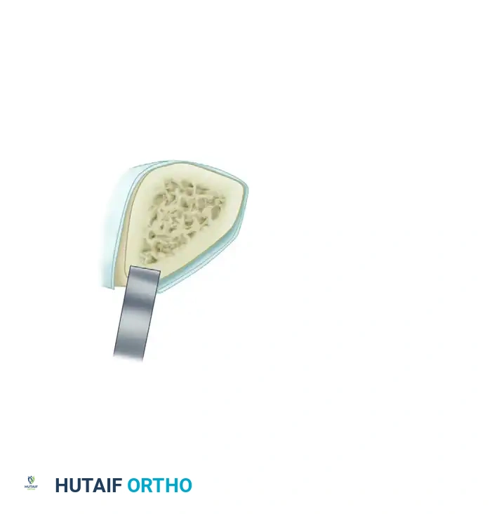 Hutaifortho's Orthopaedic Diagram