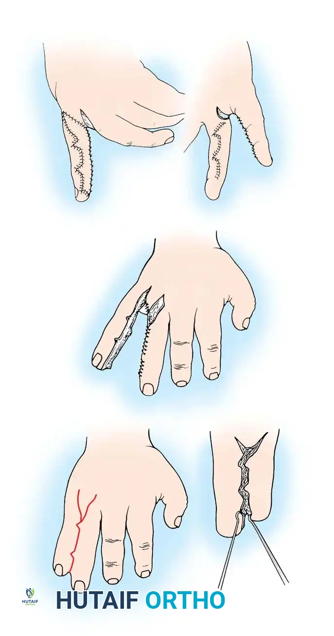 Hutaifortho's Orthopaedic Diagram