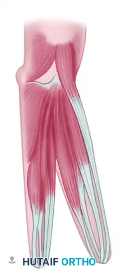 FAILURE OF FORMATION (ARREST OF DEVELOPMENT) Surgical Diagram