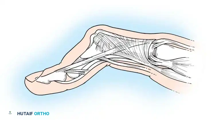 Advanced joint destruction