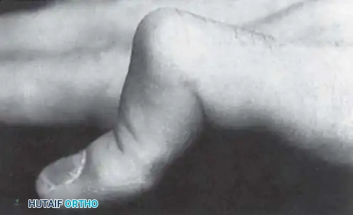 Anatomy of the intrinsic musculature