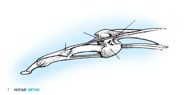 Hutaifortho's Orthopaedic Diagram
