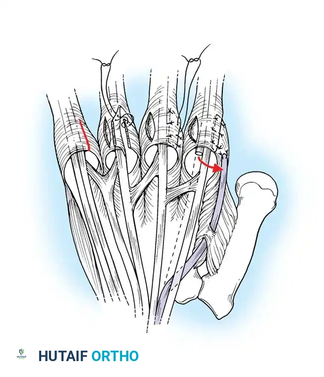 Hutaifortho's Orthopaedic Diagram